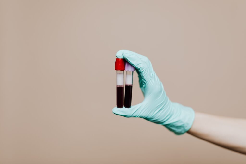 Blood sample tubes in a laboratory setting