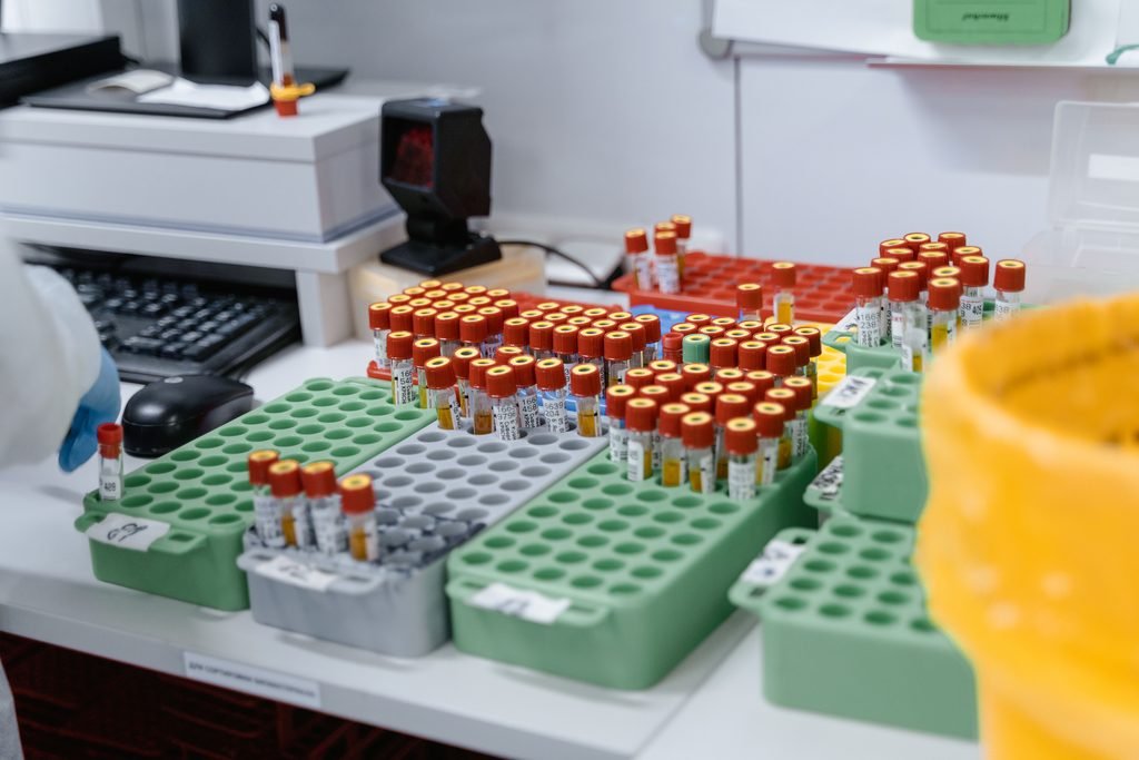 Blood Test Tubes in a laboratory environment